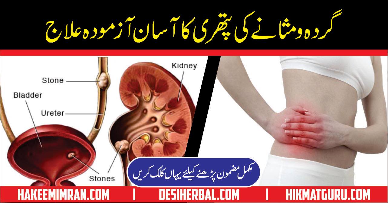 Gurday ki Pathri Desi Totkay in Urdu for Kidney Stone