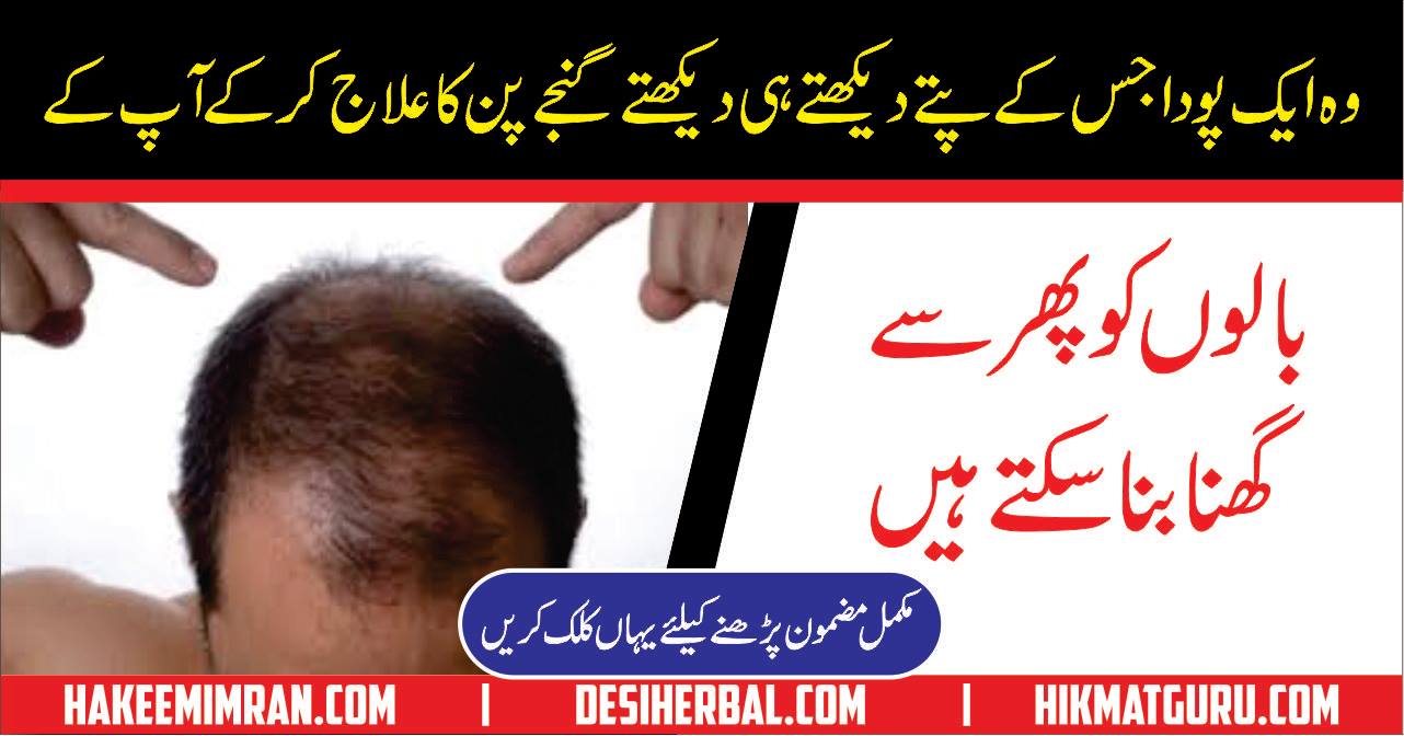 Home Remedies For Hair Fall Treatment in Urdu By Hakeem Imran Kamboh
